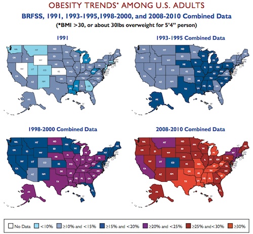 Obésité Etats-Unis