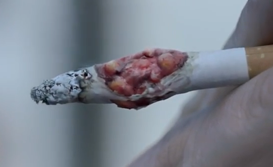 Angleterre - Campagne anti-tabac