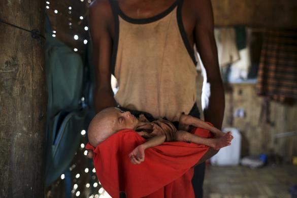 rohingya famine